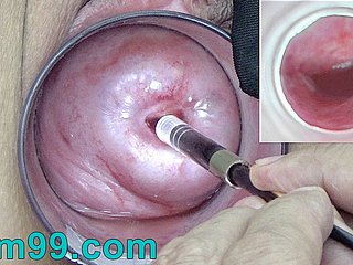 Sneezles cámara endoscopio japonés dentro del cuello uterino en la vagina Cam